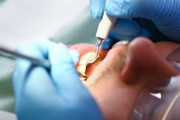 Best Emergency Root Canal Treatment in Ludowici, GA